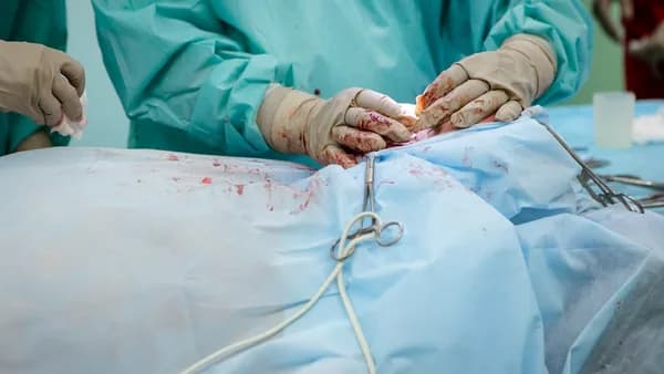 person in operation gown holding scissors