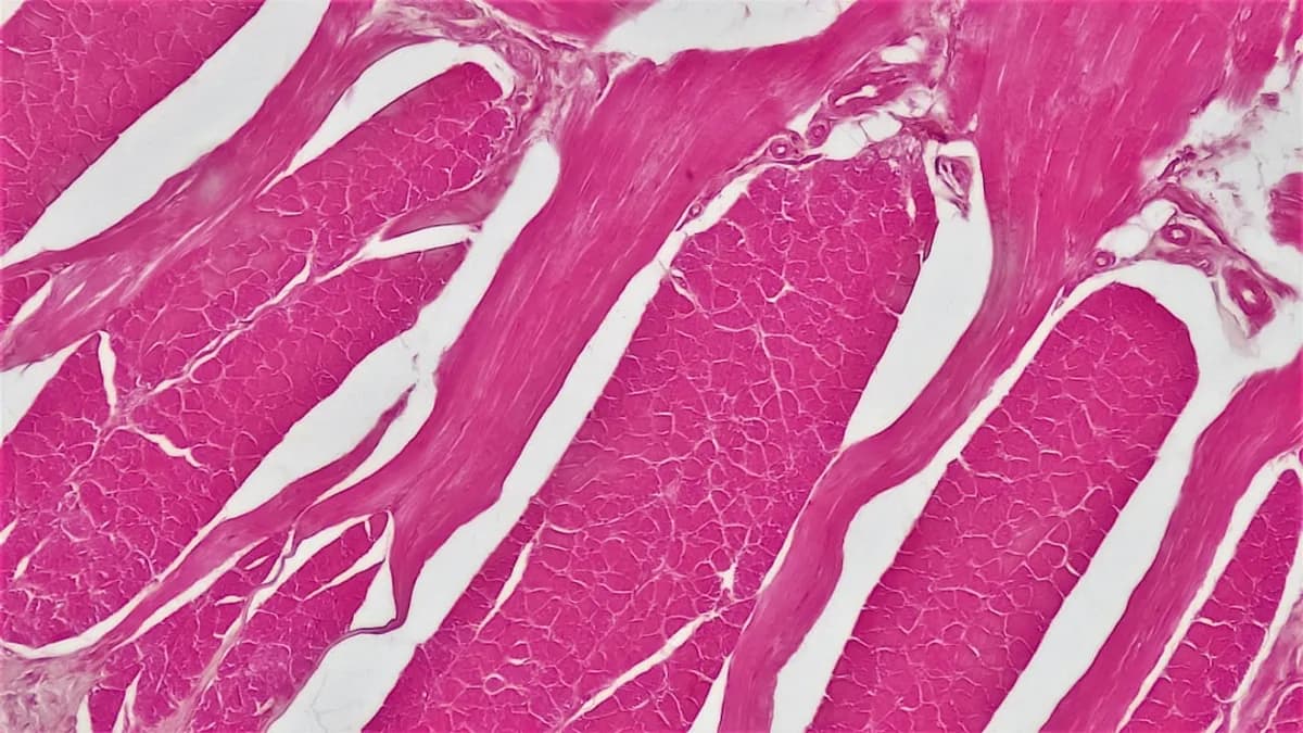 Muscle Tissue: Cross Section Whole Skeletal Muscle